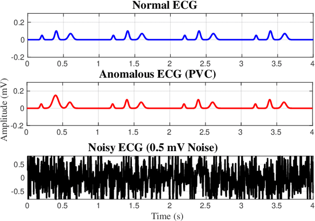 Figure 2 for Noise-Driven AI Sensors: Secure Healthcare Monitoring with PUFs