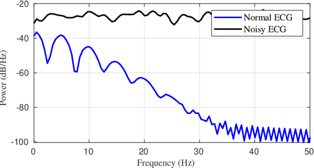 Figure 3 for Noise-Driven AI Sensors: Secure Healthcare Monitoring with PUFs