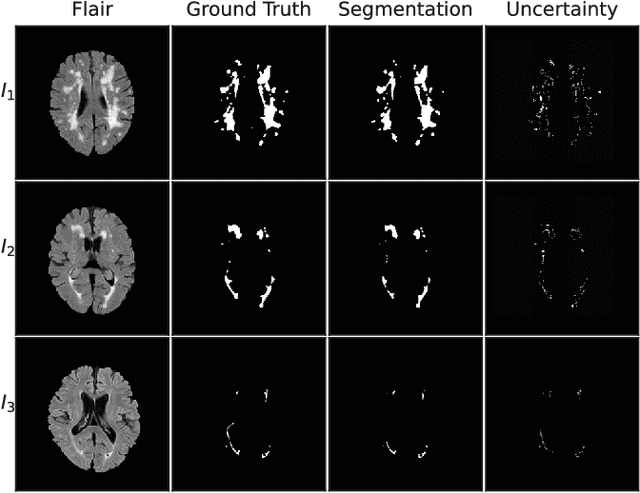 Figure 3 for Accelerating Diffusion Models via Pre-segmentation Diffusion Sampling for Medical Image Segmentation