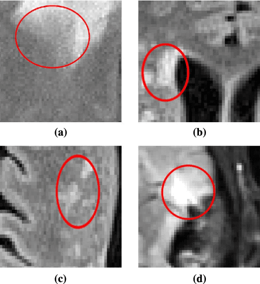 Figure 1 for DALSA: Domain Adaptation for Supervised Learning From Sparsely Annotated MR Images