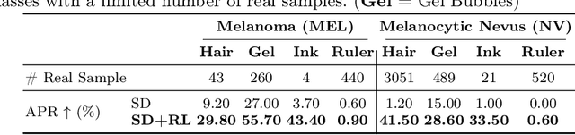 Figure 4 for RL4Med-DDPO: Reinforcement Learning for Controlled Guidance Towards Diverse Medical Image Generation using Vision-Language Foundation Models