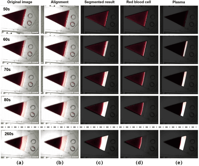 Figure 4 for Lab-in-a-Tube: A portable imaging spectrophotometer for cost-effective, high-throughput, and label-free analysis of centrifugation processes