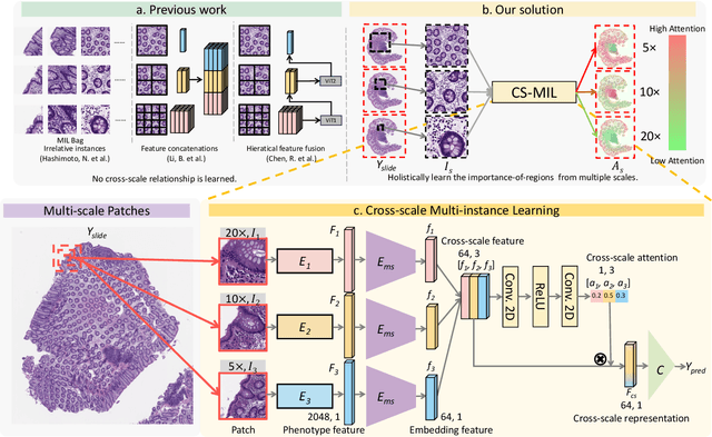 Figure 3 for Cross-scale Multi-instance Learning for Pathological Image Diagnosis