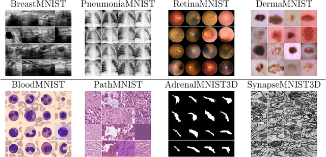 Figure 2 for Evaluating Pre-trained Convolutional Neural Networks and Foundation Models as Feature Extractors for Content-based Medical Image Retrieval