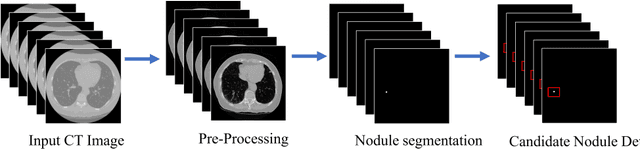 Figure 3 for Advanced Lung Nodule Segmentation and Classification for Early Detection of Lung Cancer using SAM and Transfer Learning