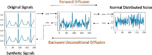 Figure 1 for BioDiffusion: A Versatile Diffusion Model for Biomedical Signal Synthesis