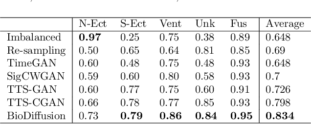 Figure 4 for BioDiffusion: A Versatile Diffusion Model for Biomedical Signal Synthesis