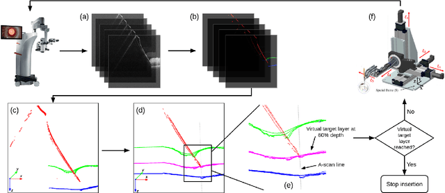 Figure 2 for Real-time Deformation-aware Control for Autonomous Robotic Subretinal Injection under iOCT Guidance