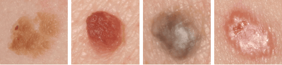 Figure 1 for Enhancing Medical Image Segmentation: Optimizing Cross-Entropy Weights and Post-Processing with Autoencoders