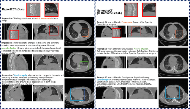 Figure 3 for Radiology Report Conditional 3D CT Generation with Multi Encoder Latent diffusion Model