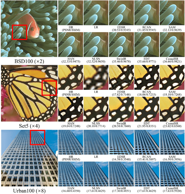 Figure 3 for CausalSR: Structural Causal Model-Driven Super-Resolution with Counterfactual Inference