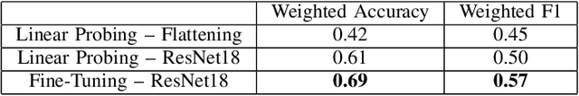 Figure 4 for CochCeps-Augment: A Novel Self-Supervised Contrastive Learning Using Cochlear Cepstrum-based Masking for Speech Emotion Recognition