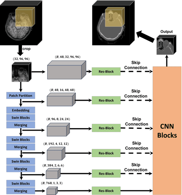 Figure 1 for Enhancing Cross-Modality Synthesis: Subvolume Merging for MRI-to-CT Conversion