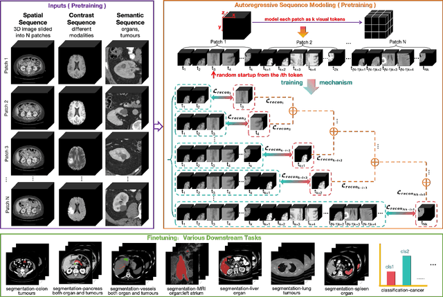 Figure 1 for Autoregressive Sequence Modeling for 3D Medical Image Representation