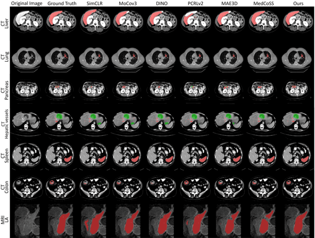 Figure 4 for Autoregressive Sequence Modeling for 3D Medical Image Representation