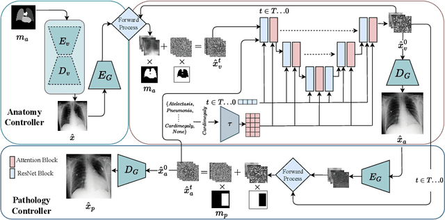 Figure 3 for XReal: Realistic Anatomy and Pathology-Aware X-ray Generation via Controllable Diffusion Model