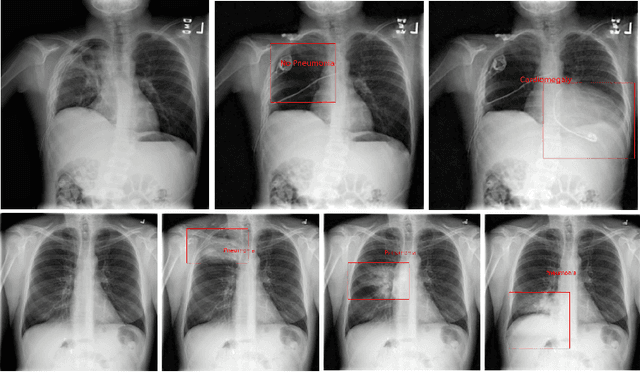 Figure 4 for XReal: Realistic Anatomy and Pathology-Aware X-ray Generation via Controllable Diffusion Model