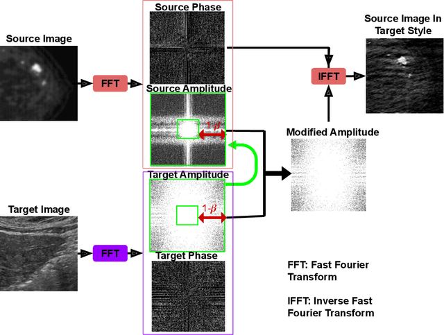 Figure 4 for Transforming Breast Cancer Diagnosis: Towards Real-Time Ultrasound to Mammogram Conversion for Cost-Effective Diagnosis