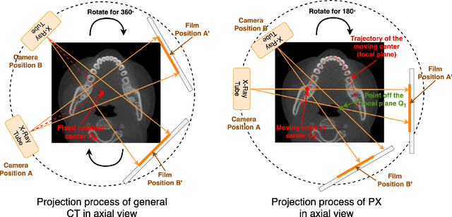 Figure 3 for Oral-NeXF: 3D Oral Reconstruction with Neural X-ray Field from Panoramic Imaging