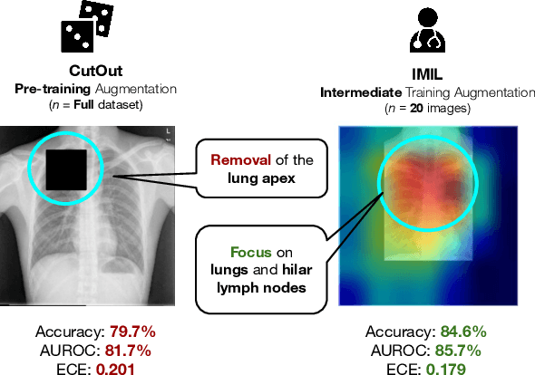 Figure 1 for IMIL: Interactive Medical Image Learning Framework