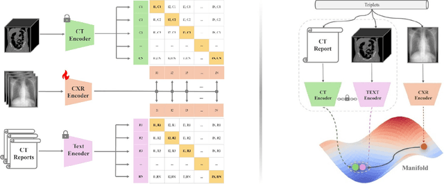 Figure 1 for X2CT-CLIP: Enable Multi-Abnormality Detection in Computed Tomography from Chest Radiography via Tri-Modal Contrastive Learning