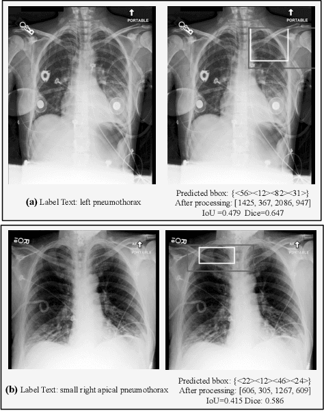 Figure 4 for Parameter-Efficient Fine-Tuning Medical Multimodal Large Language Models for Medical Visual Grounding