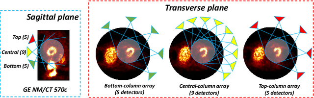 Figure 4 for Cross-domain Iterative Network for Simultaneous Denoising, Limited-angle Reconstruction, and Attenuation Correction of Low-dose Cardiac SPECT