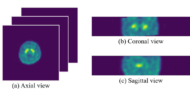 Figure 1 for Deep Convolutional Neural Networks on Multiclass Classification of Three-Dimensional Brain Images for Parkinson's Disease Stage Prediction