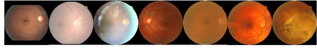 Figure 1 for FGR-Net:Interpretable fundus imagegradeability classification based on deepreconstruction learning