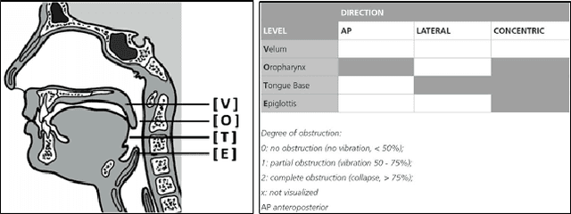 Figure 1 for Assessing Patient Eligibility for Inspire Therapy through Machine Learning and Deep Learning Models