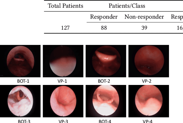 Figure 2 for Assessing Patient Eligibility for Inspire Therapy through Machine Learning and Deep Learning Models