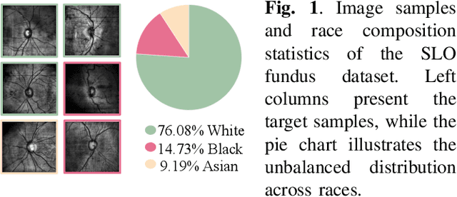 Figure 1 for Unsupervised Search for Ethnic Minorities' Medical Segmentation Training Set