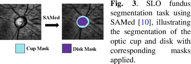 Figure 3 for Unsupervised Search for Ethnic Minorities' Medical Segmentation Training Set