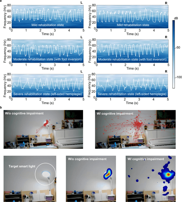 Figure 2 for A Unified Platform for At-Home Post-Stroke Rehabilitation Enabled by Wearable Technologies and Artificial Intelligence