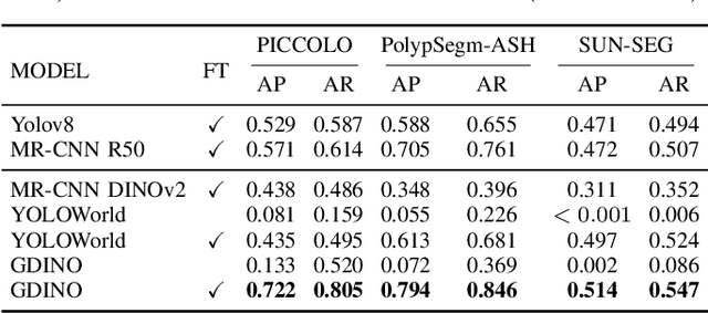 Figure 4 for AI-Assisted Colonoscopy: Polyp Detection and Segmentation using Foundation Models