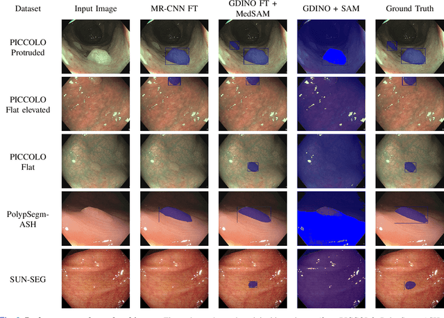 Figure 3 for AI-Assisted Colonoscopy: Polyp Detection and Segmentation using Foundation Models