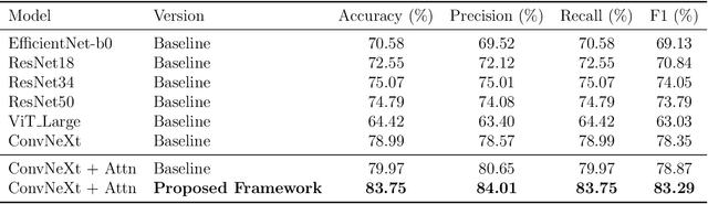Figure 4 for Knowledge Distillation Approach for SOS Fusion Staging: Towards Fully Automated Skeletal Maturity Assessment