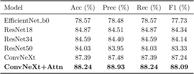 Figure 2 for Knowledge Distillation Approach for SOS Fusion Staging: Towards Fully Automated Skeletal Maturity Assessment