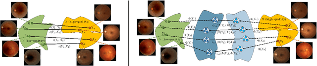 Figure 1 for Context-Aware Optimal Transport Learning for Retinal Fundus Image Enhancement