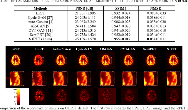 Figure 2 for S3PET: Semi-supervised Standard-dose PET Image Reconstruction via Dose-aware Token Swap