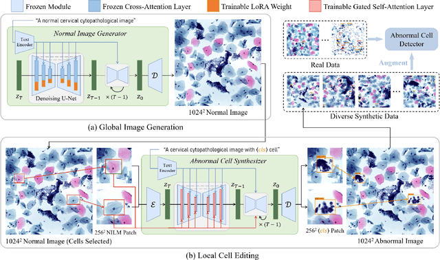 Figure 2 for Two-stage Cytopathological Image Synthesis for Augmenting Cervical Abnormality Screening