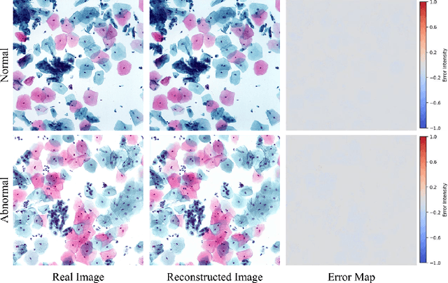 Figure 4 for Two-stage Cytopathological Image Synthesis for Augmenting Cervical Abnormality Screening