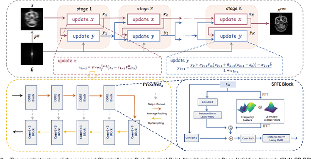Figure 2 for Re-Visible Dual-Domain Self-Supervised Deep Unfolding Network for MRI Reconstruction