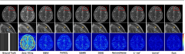 Figure 3 for Re-Visible Dual-Domain Self-Supervised Deep Unfolding Network for MRI Reconstruction