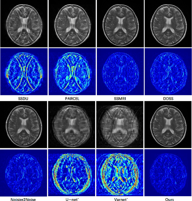 Figure 4 for Re-Visible Dual-Domain Self-Supervised Deep Unfolding Network for MRI Reconstruction