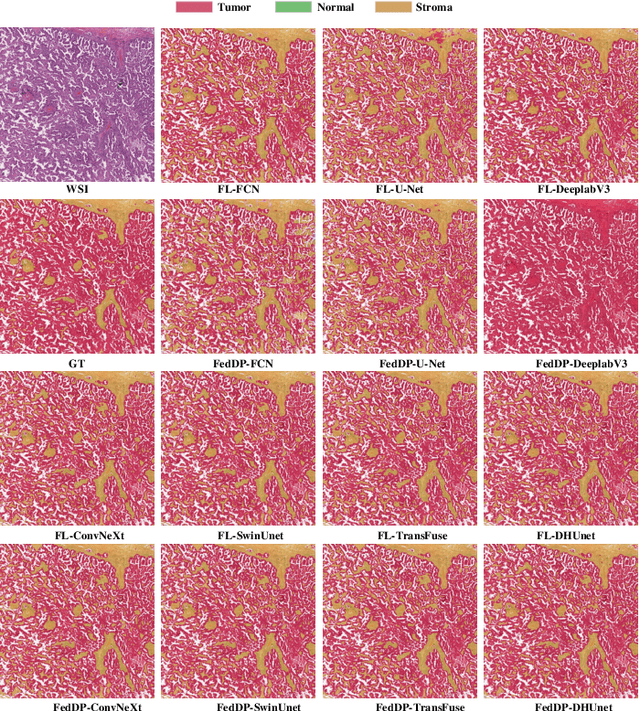 Figure 2 for FedDP: Privacy-preserving method based on federated learning for histopathology image segmentation