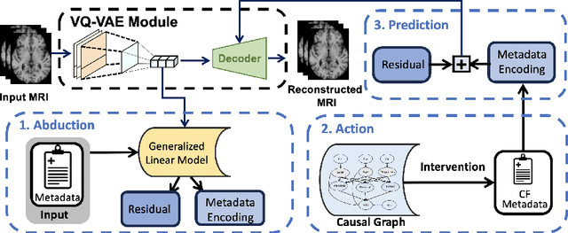 Figure 1 for Latent 3D Brain MRI Counterfactual