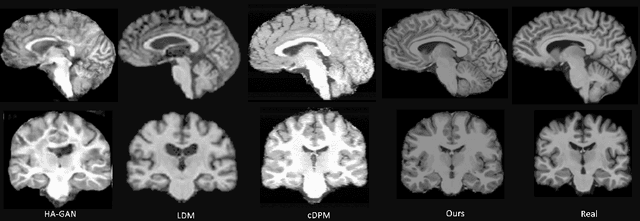 Figure 4 for Latent 3D Brain MRI Counterfactual