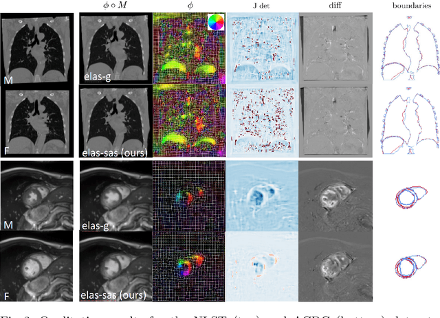 Figure 4 for Data-Driven Tissue- and Subject-Specific Elastic Regularization for Medical Image Registration