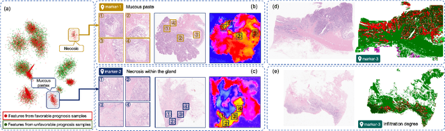 Figure 3 for SEW: Self-calibration Enhanced Whole Slide Pathology Image Analysis